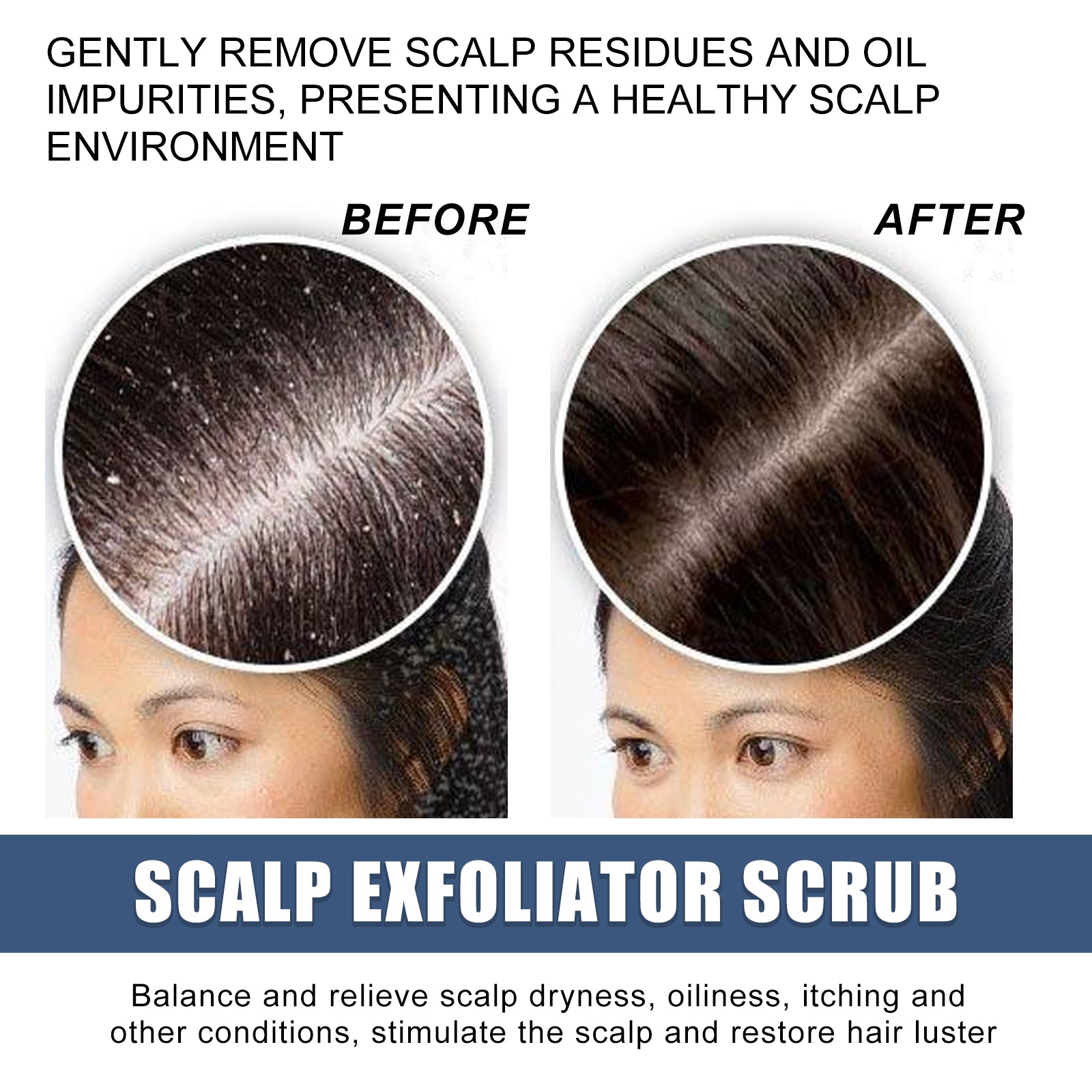 EELHOE Scalp Exfoliating Scrub Moisturizes Dry Hair And Scalp Cleansing Treatment Refreshing Scrub