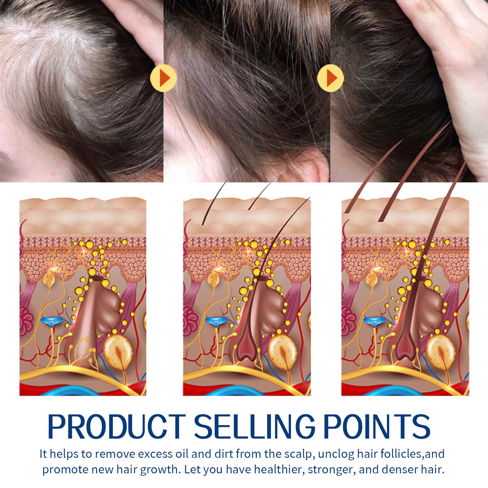 EELHOE Hair Scrub Cleans Scalp Dandruff, Soothes Itchiness, Moisturizes Dense, Firming, And Prevents Hair Loss