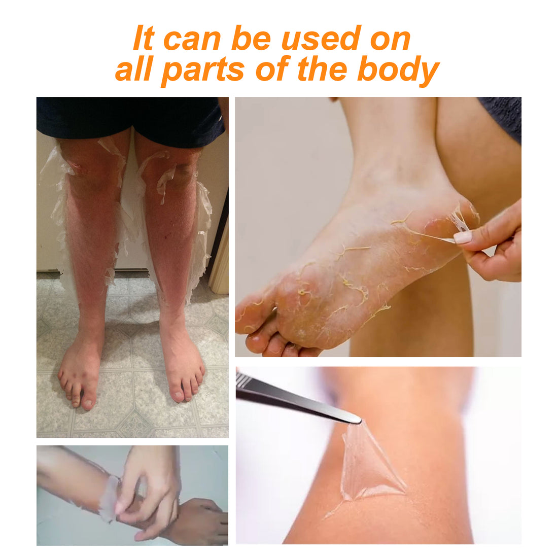 EELHOE Blackening Whitening Gel, Repair Hydrating Brightening Skin Melanin Removal Gel