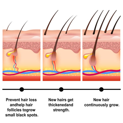 Jaysuing Batana Essential Oil Nourishes Scalp, Repairs Damaged Hair, Strengthens Hair And Prevents Loss Of Hair