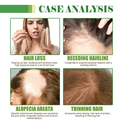OUHOE Hair Care Oil, Repair Damage Improve Dry Hair Prevent Hair Loss And Smooth Essential Oil