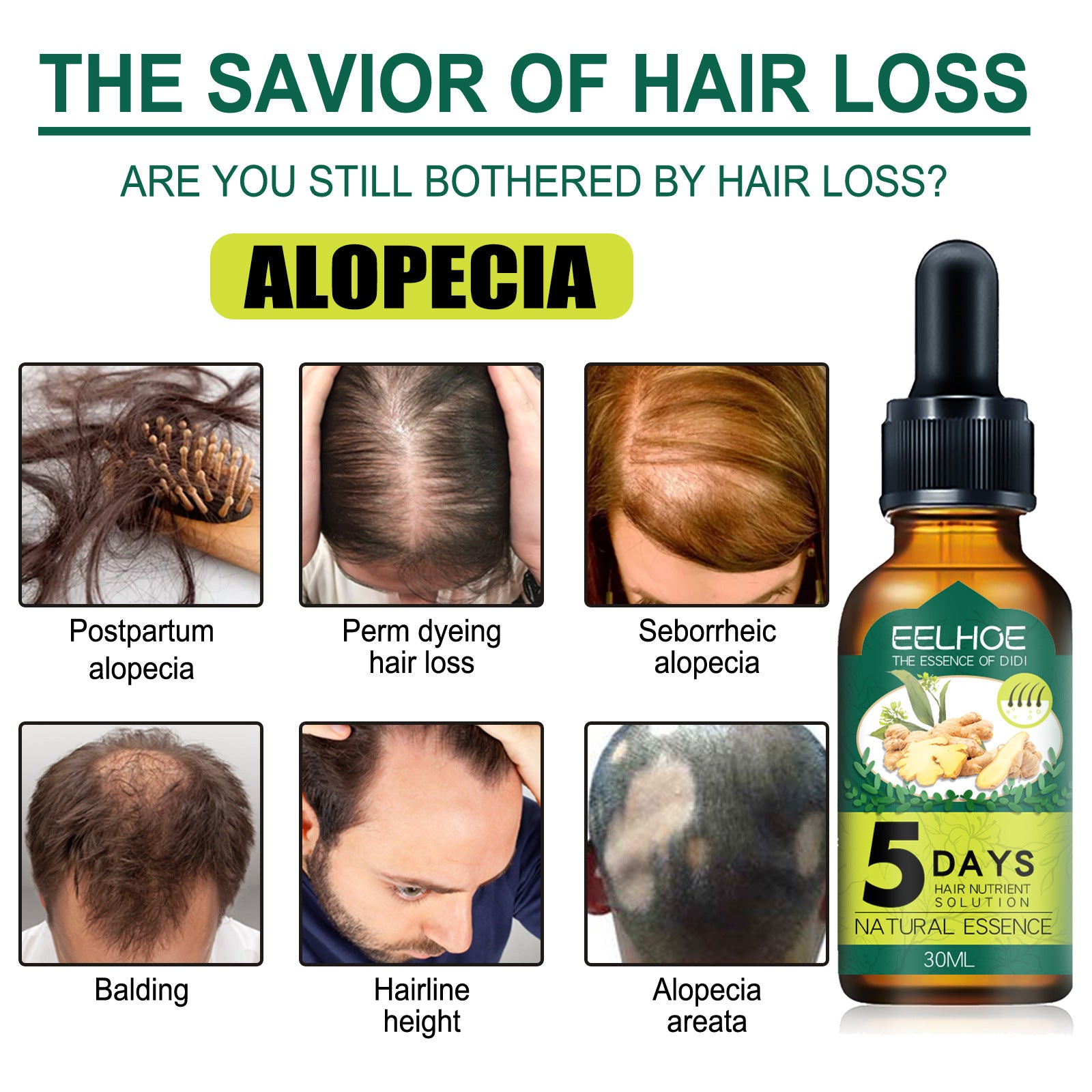 EELHOE Ginger Hair Essential Oil Moisturizes And Softens Hair And Repairs Frizzy Damaged Hair