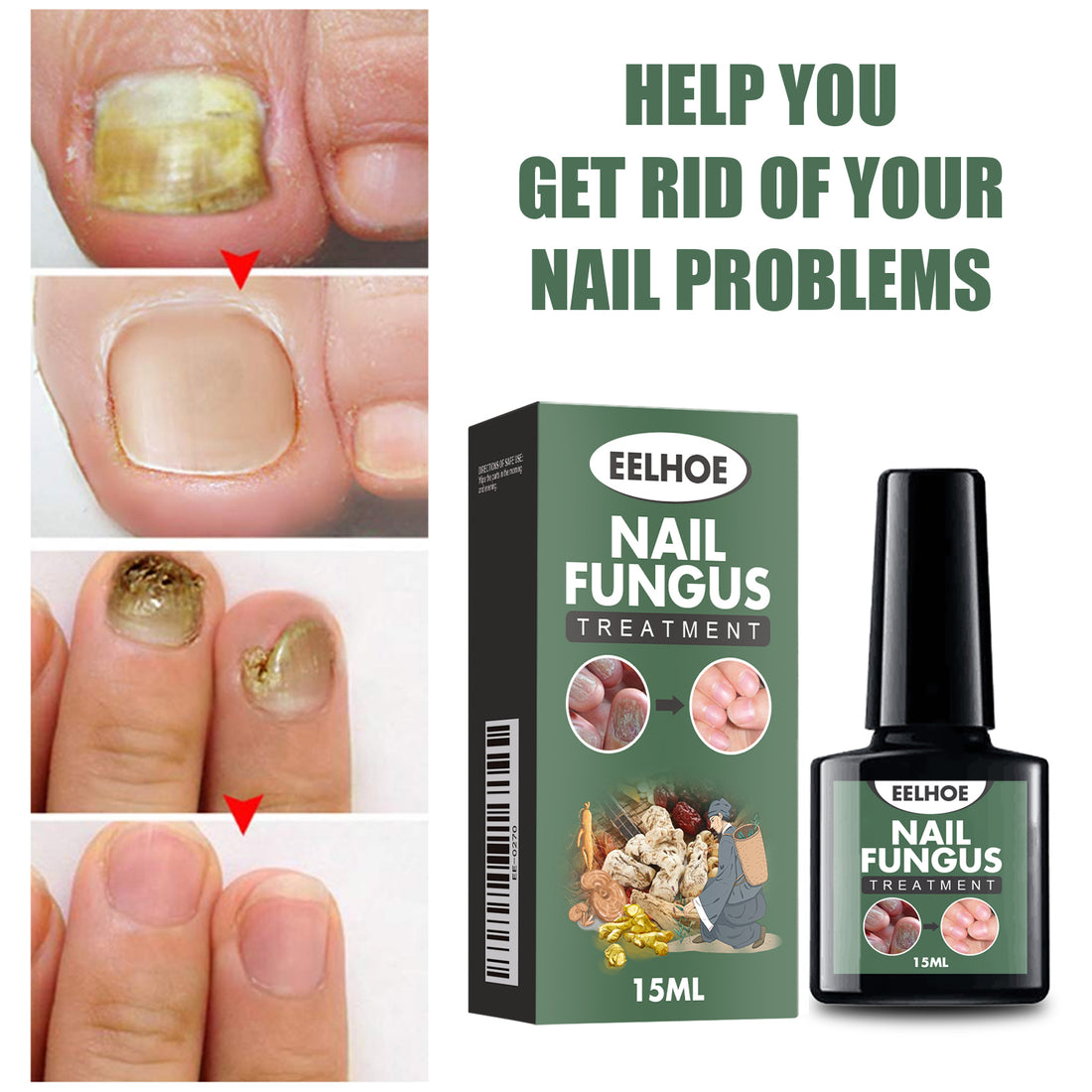 EELHOE Hand, Foot And Nail Polish Repair Solution Hand, Foot And Nail Polish Care Repair Nail Thickening And Softening Solution