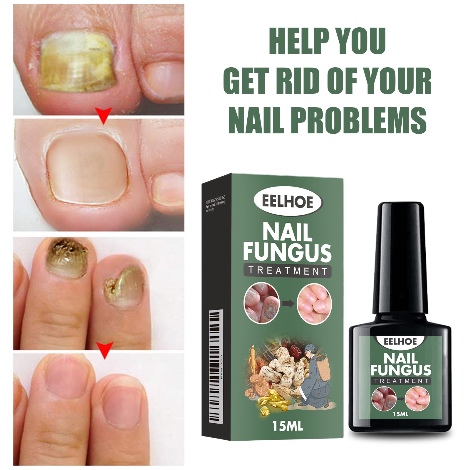 EELHOE Hand, Foot And Nail Polish Repair Solution Hand, Foot And Nail Polish Care Repair Nail Thickening And Softening Solution