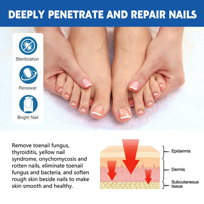 Nail Seam Care Patch, Repair Thickening Gray Nail Soft Nail Correction Nail Seam Patch